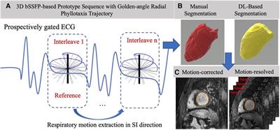 Deep learning-based left ventricular segmentation demonstrates improved performance on respiratory motion-resolved whole-heart reconstructions